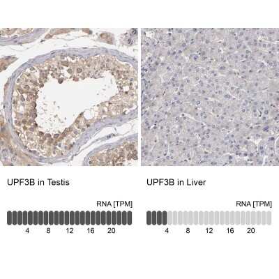 Immunohistochemistry-Paraffin: UPF3B Antibody [NBP1-83134]