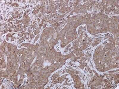 Immunohistochemistry-Paraffin: UPF3B Antibody [NBP3-12932]