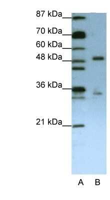 Western Blot: UPF3B Antibody [NBP1-57232]