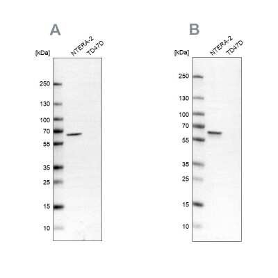Western Blot: UPF3B Antibody [NBP1-83134]