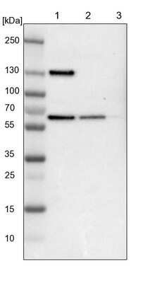Western Blot: UPF3B Antibody [NBP1-83135]