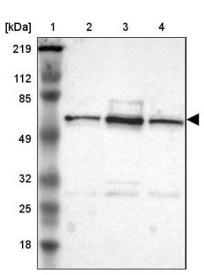 Western Blot: UPF3B Antibody [NBP1-83135]