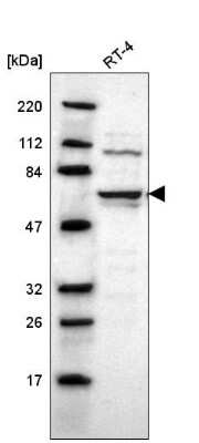 Western Blot: UPF3B Antibody [NBP2-55617]