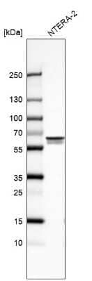 Western Blot: UPF3B Antibody [NBP2-55617]