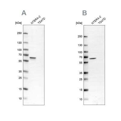 Western Blot: UPF3B Antibody [NBP2-55617]