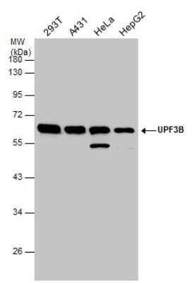 Western Blot: UPF3B Antibody [NBP3-12932]