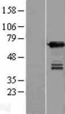 Western Blot: UPF3B Overexpression Lysate [NBP2-06382]