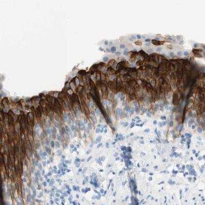 Immunohistochemistry-Paraffin: UPK3BL Antibody [NBP2-46656]