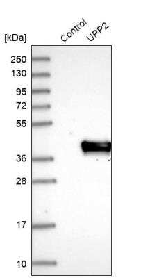 Western Blot: UPP2 Antibody [NBP1-80646]