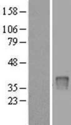 Western Blot: UPP2 Overexpression Lysate [NBL1-17626]