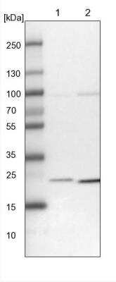 Western Blot: UQCC Antibody [NBP1-90766]