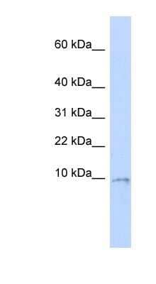 Western Blot: UQCR10 Antibody [NBP1-62349]