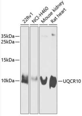 Western Blot: UQCR10 AntibodyBSA Free [NBP2-93778]