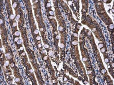 Immunohistochemistry-Paraffin: UQCRB Antibody [NBP3-12970]