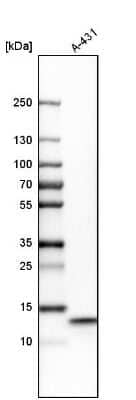 Western Blot: UQCRB Antibody [NBP1-80860]