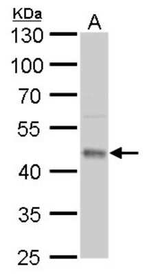 Western Blot: UQCRC1 Antibody (1311) [NBP2-43596]