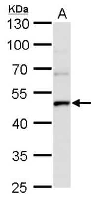 Western Blot: UQCRC1 Antibody (1311) [NBP2-43596]