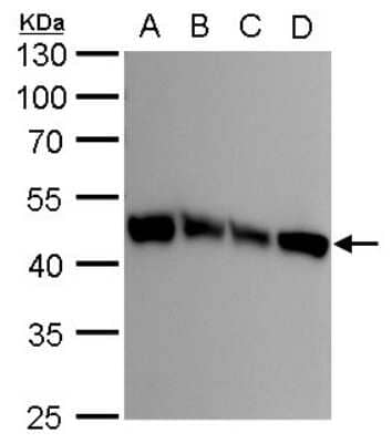 Western Blot: UQCRC1 Antibody (139) [NBP2-43597]