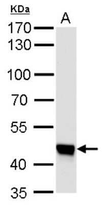 Western Blot: UQCRC1 Antibody (139) [NBP2-43597]