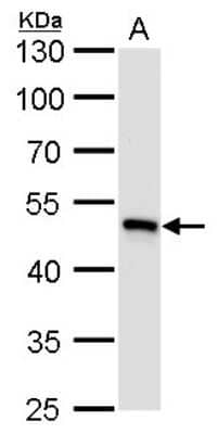 Western Blot: UQCRC1 Antibody (139) [NBP2-43597]