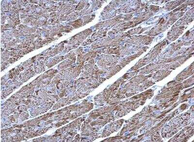 Immunohistochemistry-Paraffin: UQCRC1 Antibody [NBP1-32045]