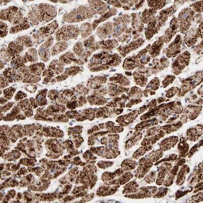Immunohistochemistry-Paraffin: UQCRC1 Antibody [NBP1-85328]