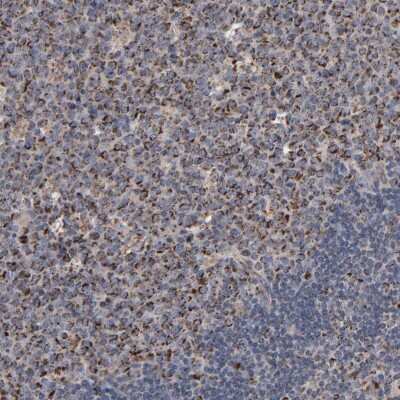 Immunohistochemistry-Paraffin: UQCRC1 Antibody [NBP1-85328]