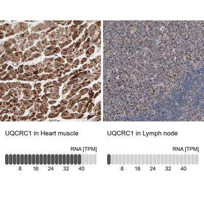 Immunohistochemistry-Paraffin: UQCRC1 Antibody [NBP1-85328]