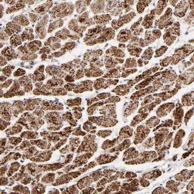 Immunohistochemistry-Paraffin: UQCRC1 Antibody [NBP1-85329]