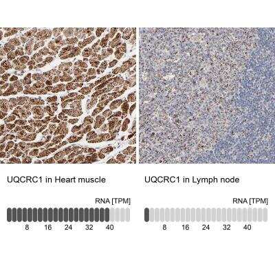 Immunohistochemistry-Paraffin: UQCRC1 Antibody [NBP1-85329]