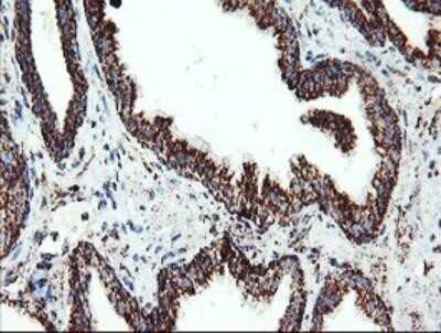 Immunohistochemistry: UQCRC1 Antibody (OTI1G6) - Azide and BSA Free [NBP2-74796]