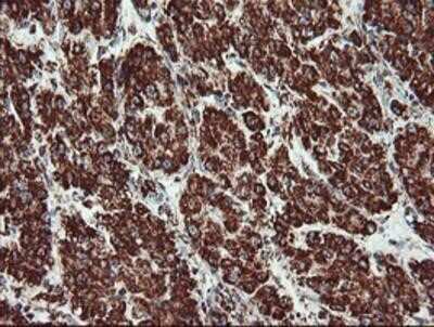 Immunohistochemistry-Paraffin: UQCRC1 Antibody (OTI1G6) [NBP2-03825]