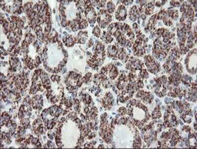 Immunohistochemistry-Paraffin: UQCRC1 Antibody (OTI1G6) [NBP2-03825]