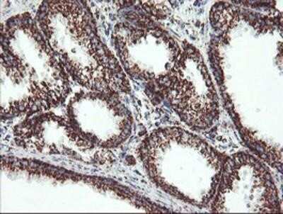 Immunohistochemistry-Paraffin: UQCRC1 Antibody (OTI1G6) [NBP2-03825]