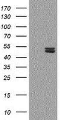 Western Blot: UQCRC1 Antibody (OTI1G6) [NBP2-03825]