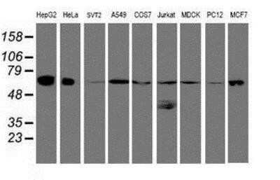 Western Blot: UQCRC1 Antibody (OTI1G6) [NBP2-03825]