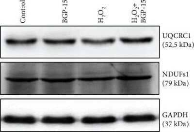 Western Blot: UQCRC1 Antibody (OTI1G6) [NBP2-03825]