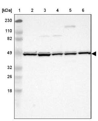 Western Blot: UQCRC1 Antibody [NBP1-85328]
