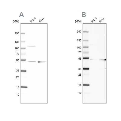 Western Blot: UQCRC1 Antibody [NBP1-85328]