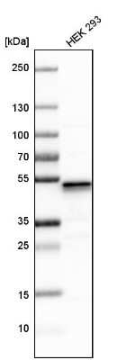 Western Blot: UQCRC1 Antibody [NBP1-85329]