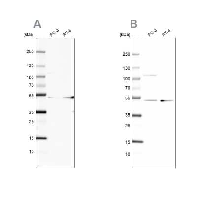 Western Blot: UQCRC1 Antibody [NBP1-85329]