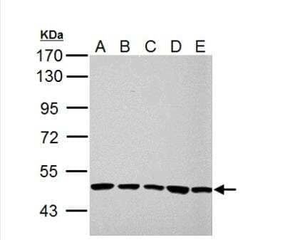Western Blot: UQCRC1 Antibody [NBP2-20815]