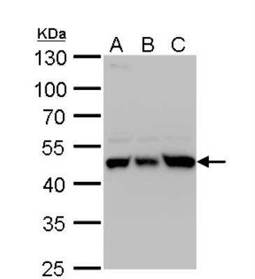 Western Blot: UQCRC1 Antibody [NBP2-20815]