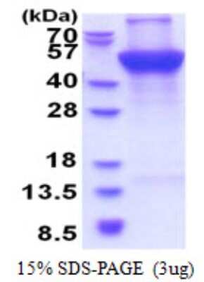 SDS-PAGE: Recombinant Human UQCRC1 His Protein [NBP2-51608]