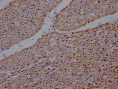 Immunohistochemistry: UQCRC2 Antibody (2F6) [NBP3-15182]