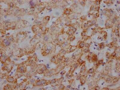 Immunohistochemistry: UQCRC2 Antibody (2F6) [NBP3-15182]