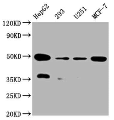 Western Blot: UQCRC2 Antibody (2F6) [NBP3-15182]