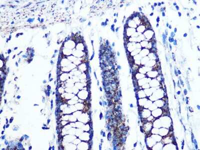 Immunohistochemistry-Paraffin: UQCRC2 Antibody (3E3O8) [NBP3-16390]