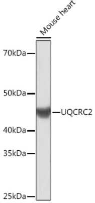Western Blot: UQCRC2 Antibody (3E3O8) [NBP3-16390]