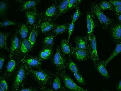 Immunocytochemistry/ Immunofluorescence: UQCRC2 Antibody [NBP2-97364]